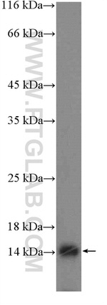 FAM103A1 Antibody in Western Blot (WB)