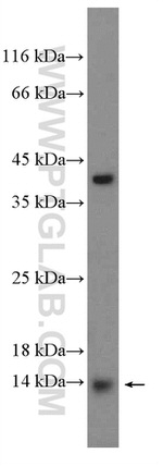 FAM103A1 Antibody in Western Blot (WB)