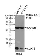 COX16 Antibody in Western Blot (WB)