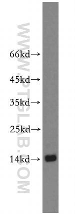 ZNF593 Antibody in Western Blot (WB)