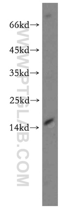 ZNF593 Antibody in Western Blot (WB)
