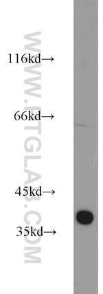 CCDC94 Antibody in Western Blot (WB)