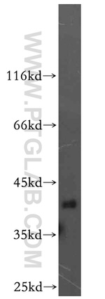 CCDC94 Antibody in Western Blot (WB)