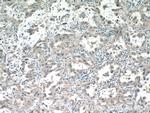 ALDH3B1 Antibody in Immunohistochemistry (Paraffin) (IHC (P))