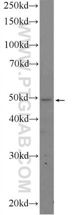 ALDH3B1 Antibody in Western Blot (WB)