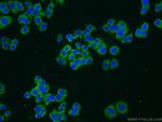 TRPC1 Antibody in Immunocytochemistry (ICC/IF)