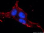 ANO8 Antibody in Immunocytochemistry (ICC/IF)