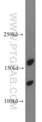 ANO8 Antibody in Western Blot (WB)