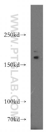 ADCY3 Antibody in Western Blot (WB)
