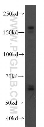 VLDLR Antibody in Western Blot (WB)