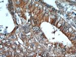 CEACAM3 Antibody in Immunohistochemistry (Paraffin) (IHC (P))