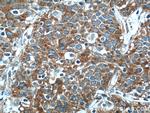 FUT4 Antibody in Immunohistochemistry (Paraffin) (IHC (P))