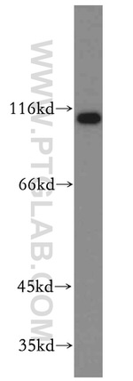 FUT4 Antibody in Western Blot (WB)