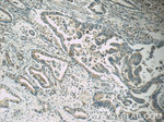 MRP5 Antibody in Immunohistochemistry (Paraffin) (IHC (P))