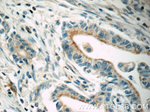 MRP5 Antibody in Immunohistochemistry (Paraffin) (IHC (P))