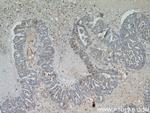 MRP5 Antibody in Immunohistochemistry (Paraffin) (IHC (P))