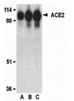 Angiotensin Converting Enzyme 2 (ACE2) Antibody in Western Blot (WB)