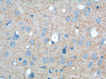 ATP9A Antibody in Immunohistochemistry (Paraffin) (IHC (P))