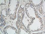 ATP9A Antibody in Immunohistochemistry (Paraffin) (IHC (P))