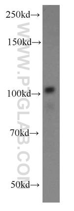 ATP9A Antibody in Western Blot (WB)