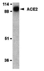 Angiotensin Converting Enzyme 2 (ACE2) Antibody in Western Blot (WB)