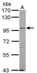 Angiotensin Converting Enzyme 2 (ACE2) Antibody in Western Blot (WB)