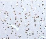 Angiotensin Converting Enzyme 2 (ACE2) Antibody in Immunohistochemistry (Paraffin) (IHC (P))