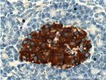 PRSS27 Antibody in Immunohistochemistry (Paraffin) (IHC (P))