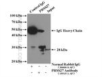 PRSS27 Antibody in Immunoprecipitation (IP)