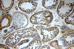 TXNRD3 Antibody in Immunohistochemistry (Paraffin) (IHC (P))