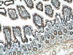 FAAH2 Antibody in Immunohistochemistry (Paraffin) (IHC (P))