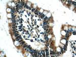 FAAH2 Antibody in Immunohistochemistry (Paraffin) (IHC (P))