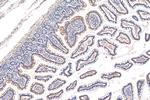 FAAH2 Antibody in Immunohistochemistry (Paraffin) (IHC (P))