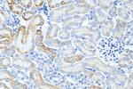FAAH2 Antibody in Immunohistochemistry (Paraffin) (IHC (P))
