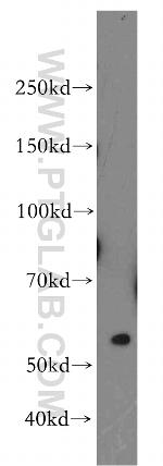 CES7 Antibody in Western Blot (WB)