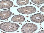 NY-ESO-1 Antibody in Immunohistochemistry (Paraffin) (IHC (P))