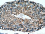 NY-ESO-1 Antibody in Immunohistochemistry (Paraffin) (IHC (P))
