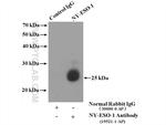 NY-ESO-1 Antibody in Immunoprecipitation (IP)