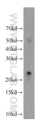 NY-ESO-1 Antibody in Western Blot (WB)