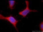 SPANXA2/SPANXA1 Antibody in Immunocytochemistry (ICC/IF)