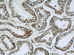 SPANXA2/SPANXA1 Antibody in Immunohistochemistry (Paraffin) (IHC (P))