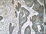 SPANXA2/SPANXA1 Antibody in Immunohistochemistry (Paraffin) (IHC (P))
