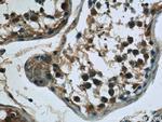 SPANXA2/SPANXA1 Antibody in Immunohistochemistry (Paraffin) (IHC (P))
