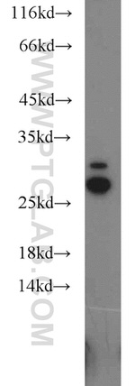 SPANXA2/SPANXA1 Antibody in Western Blot (WB)
