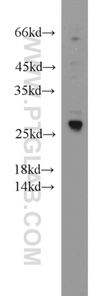 SPANXA2/SPANXA1 Antibody in Western Blot (WB)