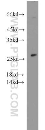 SPANXA2/SPANXA1 Antibody in Western Blot (WB)