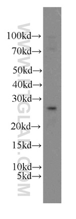 SPANXA2/SPANXA1 Antibody in Western Blot (WB)