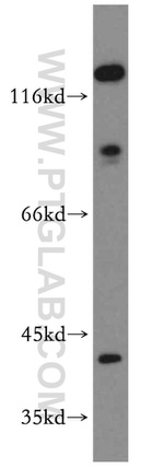 CAPG Antibody in Western Blot (WB)