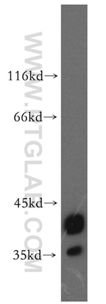 CAPG Antibody in Western Blot (WB)