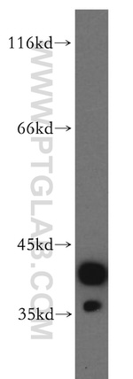 CAPG Antibody in Western Blot (WB)